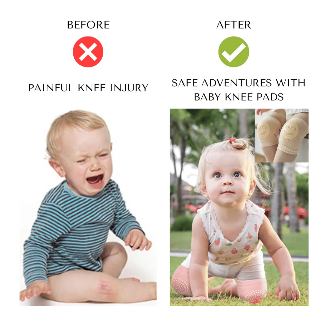 Baby Knee Pads for Crawling - Anti-Slip Protection for Babies